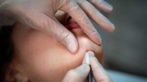 explication thermolyse