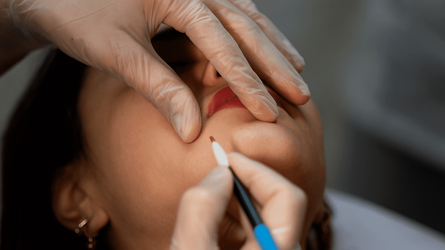 Épilation électrolyse Paris