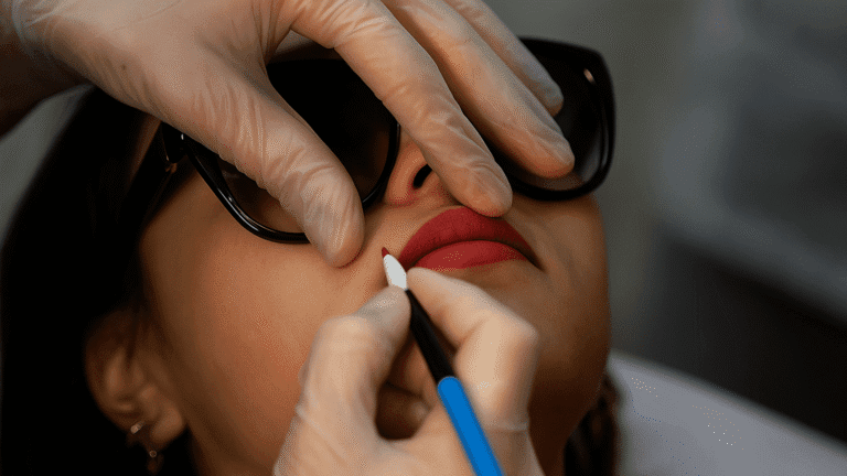 Thermolyse en été freed paris