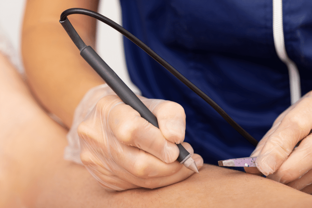 Qu’est ce qu’Apilus exactement ?